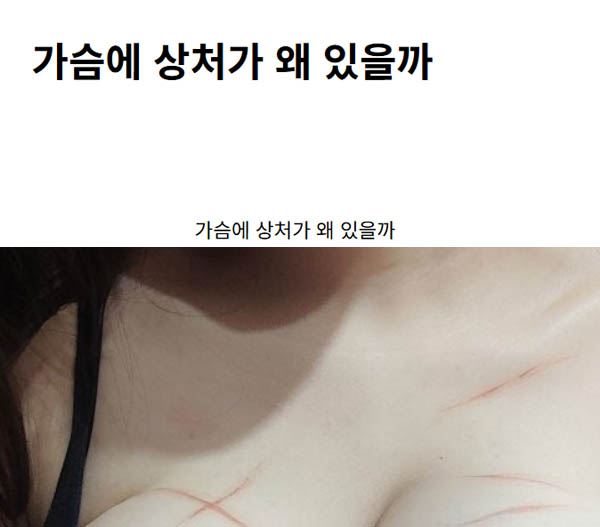 가슴에 상처가 왜 있을까
